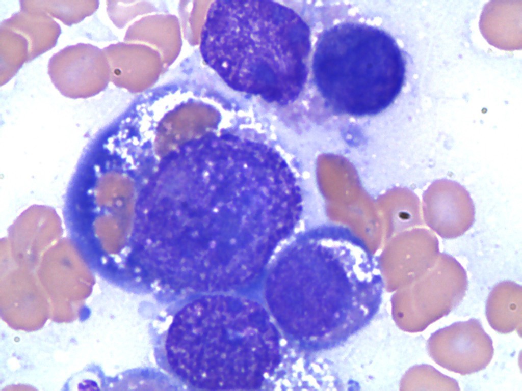 Figure 3: Erythrophagocytosis